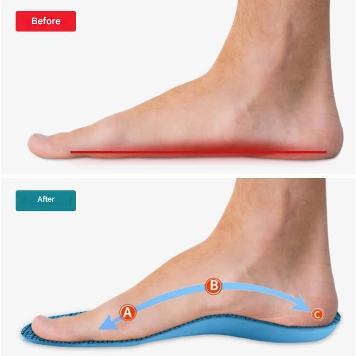 Orthopedic arch support insoles for work & sports shoes, reducing foot pain from plantar fasciitis.