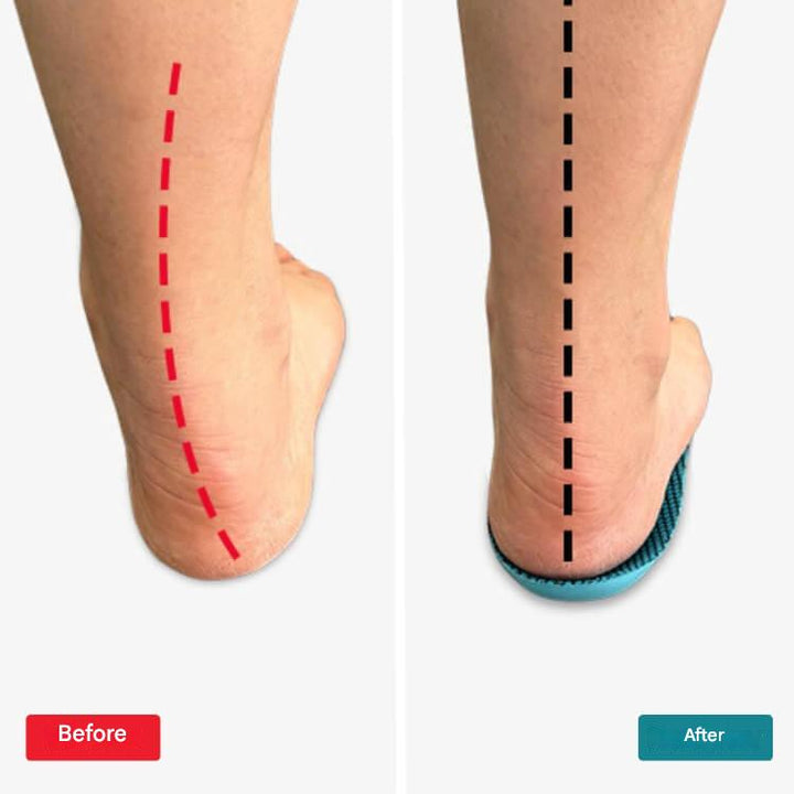Advanced orthopedic insoles with arch support for lasting comfort, ideal for daily wear & foot pain relief.