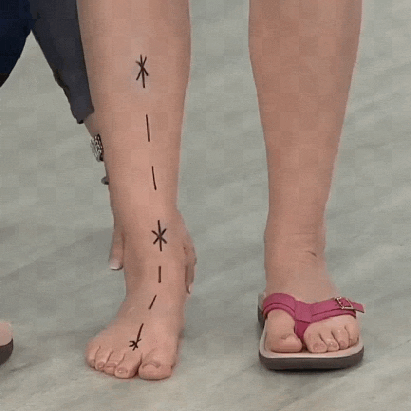 Detailed view of women's orthopedic flip-flops, highlighting arch support and comfort-focused materials for summer.